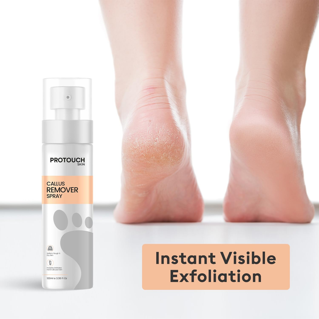 Protouch Callus Remover Spray 100ml instant visible exfoliation on cracked heels