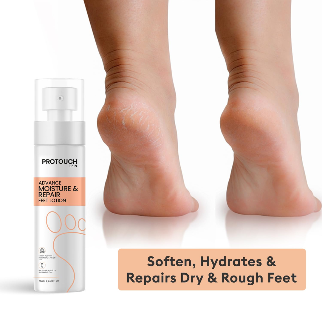 Protouch Advance Moisture & Repair Feet Lotion 100ml for dry rough cracked heels, before and after