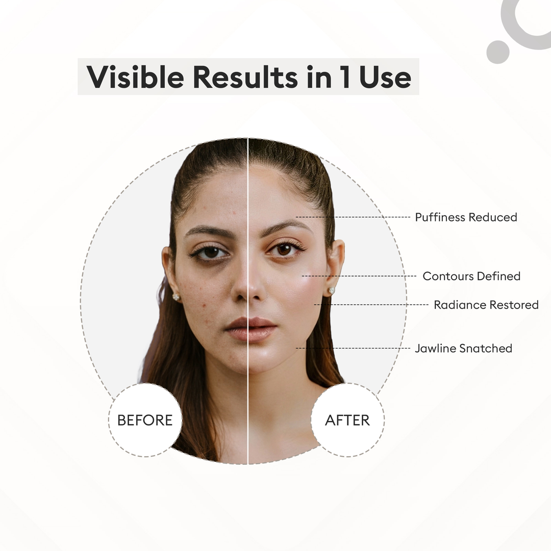 Protouch Glow Pro Microcurrent Facial Toning Device Etoupe before and after results