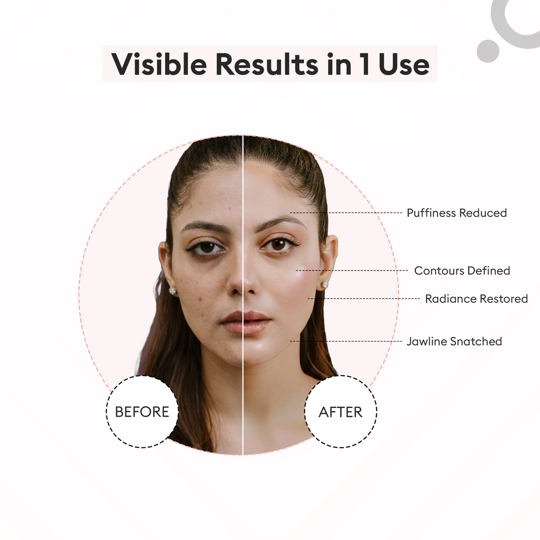 Protouch Glow Pro Microcurrent Facial Toning Device BLUSH before and after results in 1 use