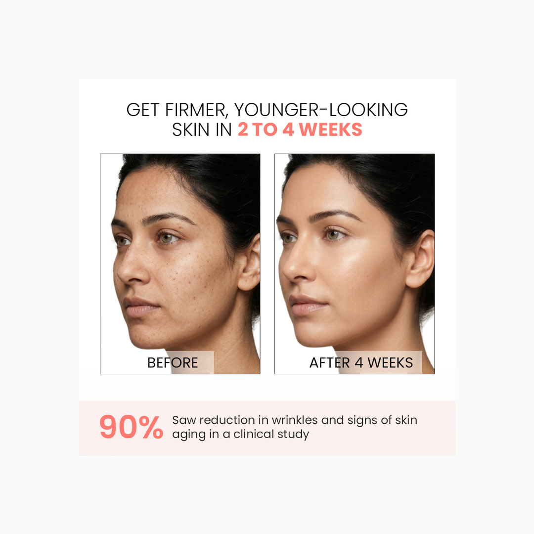 Protouch Spectra Glow LED Face Mask before and after 4 weeks results