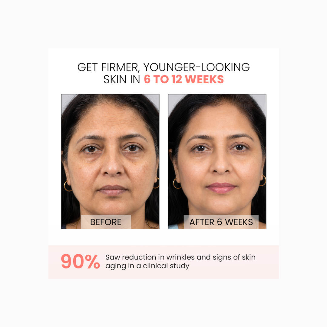 Protouch Spectra Glow LED Face Mask before and after 6 weeks wrinkle results