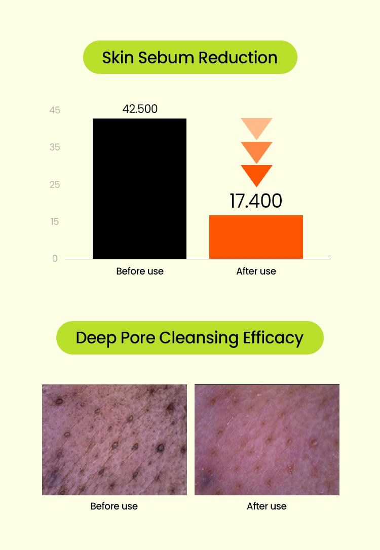Beplain Mung Bean Cleansing Foam skin sebum reduction and deep pore cleansing before and after