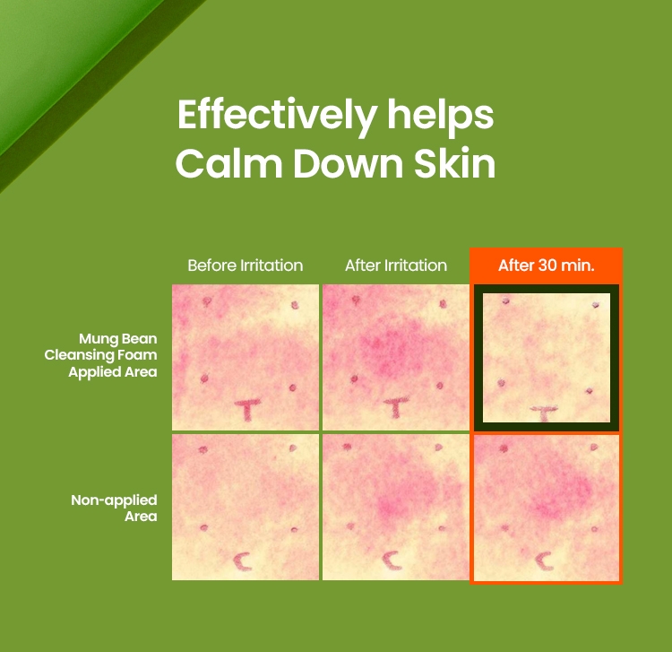 Beplain Mung Bean Cleansing Foam calms skin irritation test before and after 30 minutes