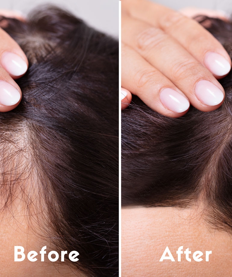 Coco Crush Cold-Pressed Rosemary Lavender Hair Oil, Prevents Hair Loss & Stimulates Hair Growth - 100ml – image 5 of 8
