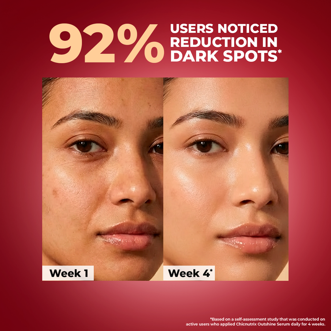 Chicnutrix Outshine Serum before and after, week 1 vs week 4 dark spot reduction