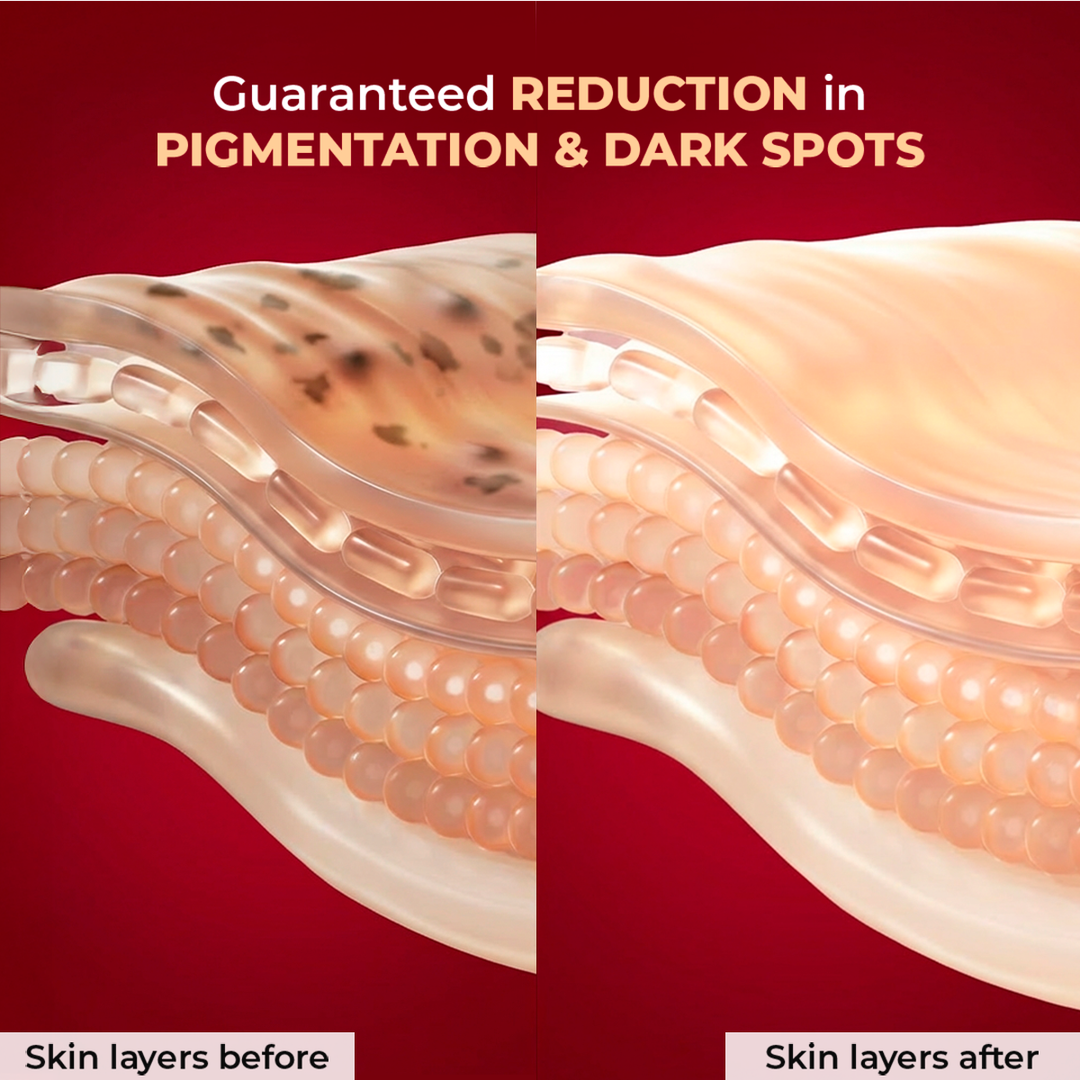 Chicnutrix Outshine Serum skin layers before and after, pigmentation and dark spots