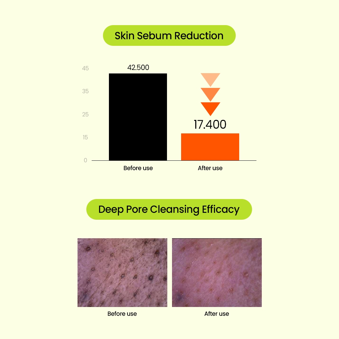 Beplain Mung Bean pH-Balanced Cleansing Foam sebum reduction and deep pore cleansing before and after