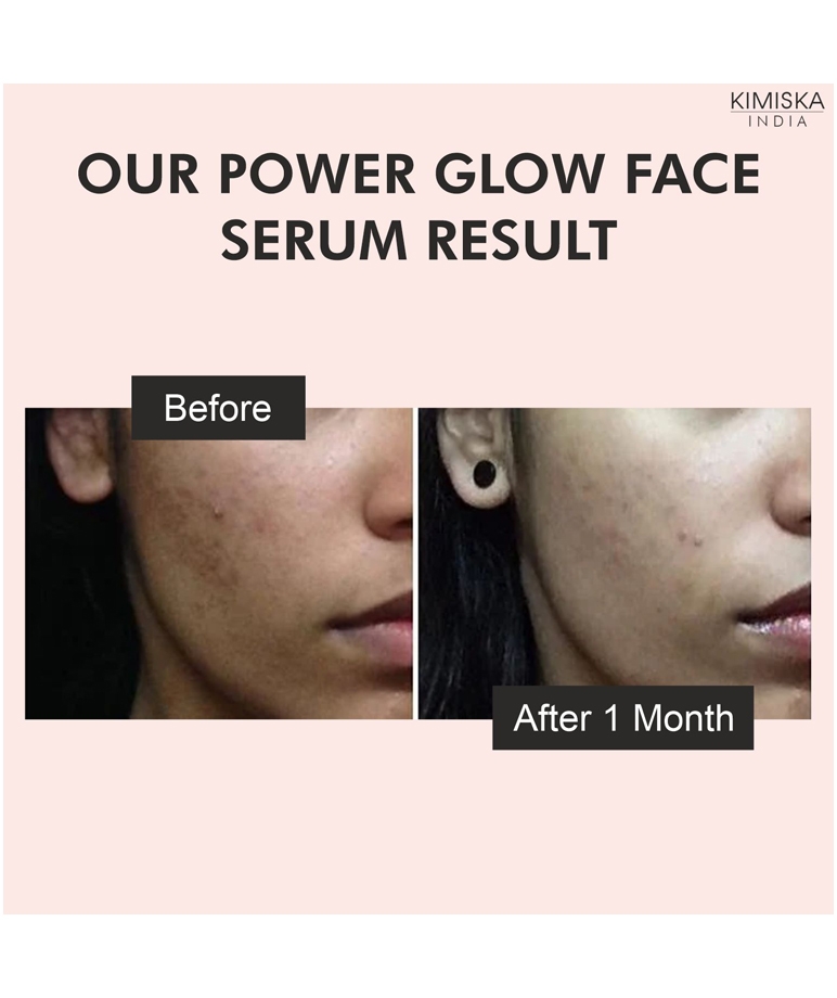 THE LOVE CO Power Glow Face Serum - 2% Glycolic Acid + 0.5% Hyaluronic Acid - 30ml – image 5 of 6