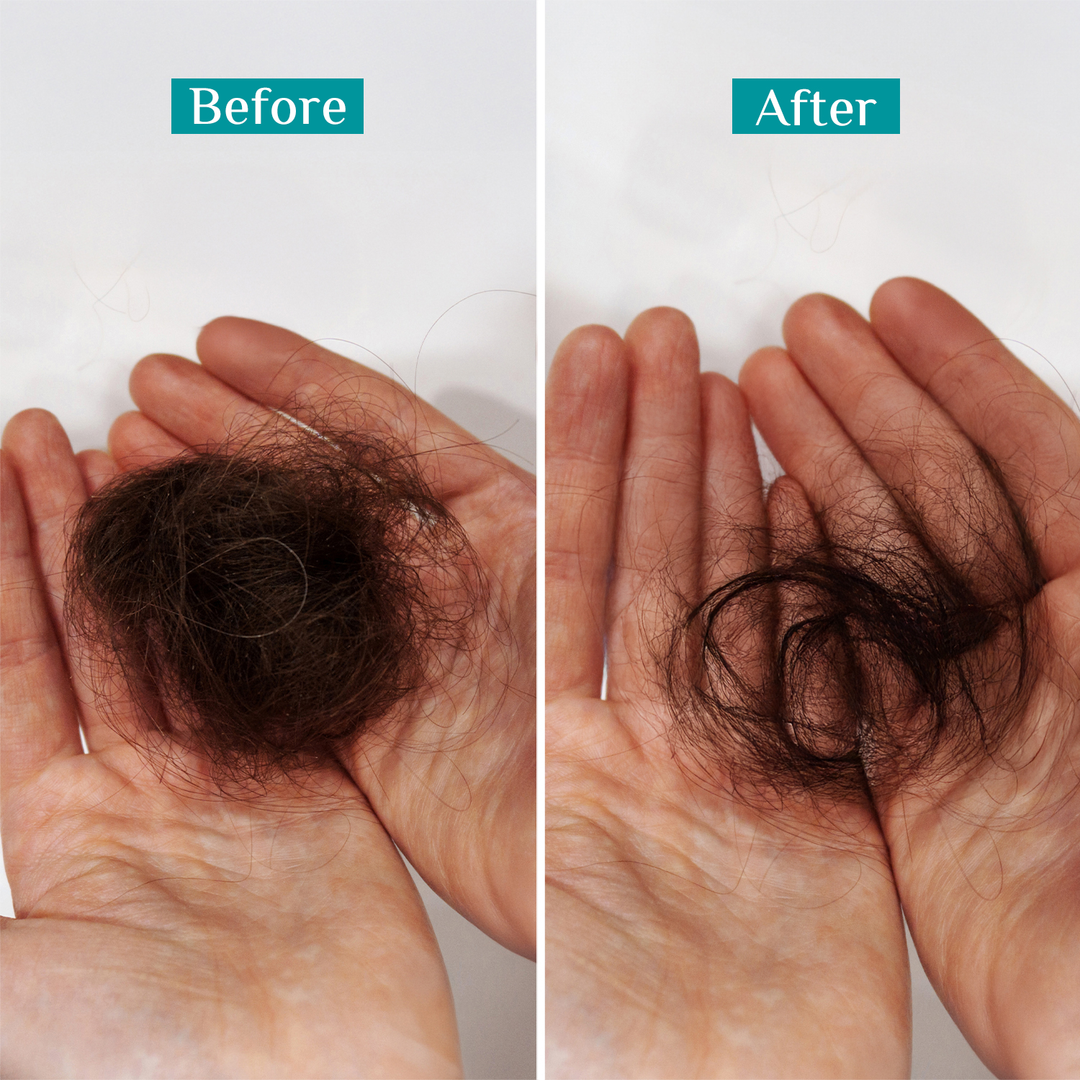 Pilgrim Redensyl & Anagain Hairfall Control Shampoo – image 4 of 9