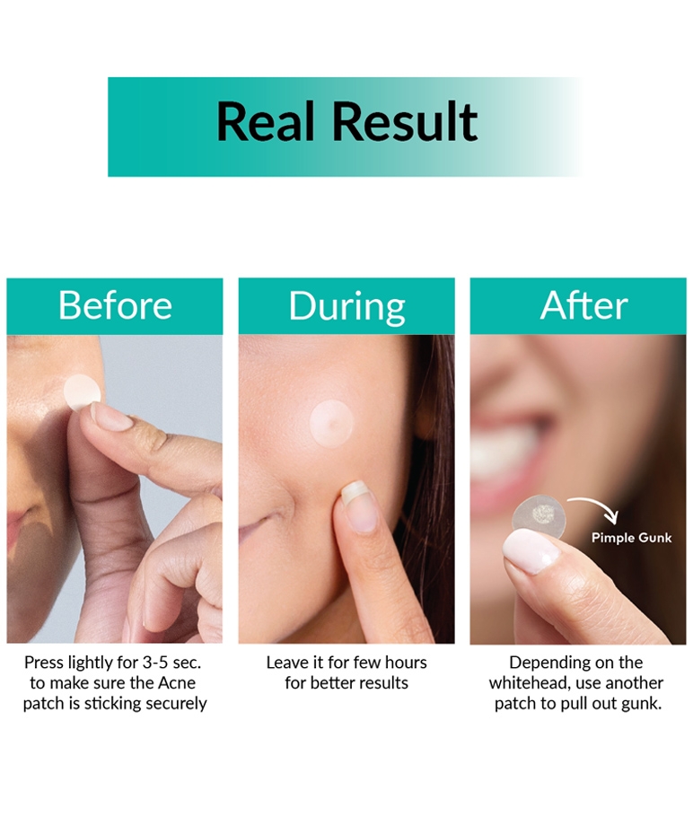 Priveda Spot Clearing Acne Pimple Patch 57 patches before, during and after use how to apply