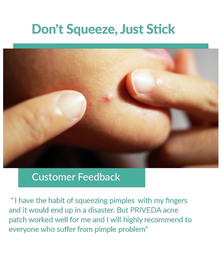 Priveda Acne Pimple Patch customer feedback review, don't squeeze just stick