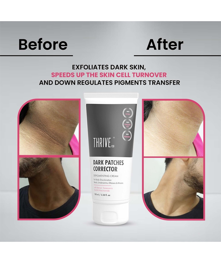 ThriveCo Dark Patches Corrector – image 5 of 6