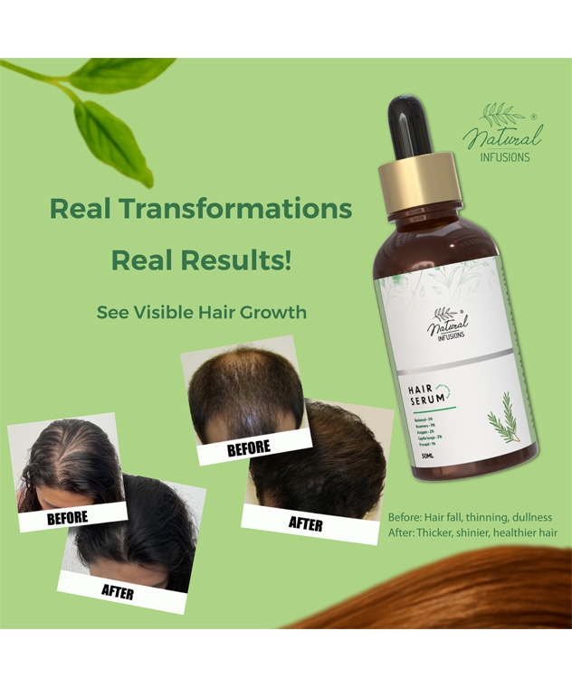 Natural Infusions Hair Growth Serum with 5% Redensyl | 8+ Natural Extracts | Hair Fall Control | For Men and Women | 50ml (Pack of 12) – image 2 of 4