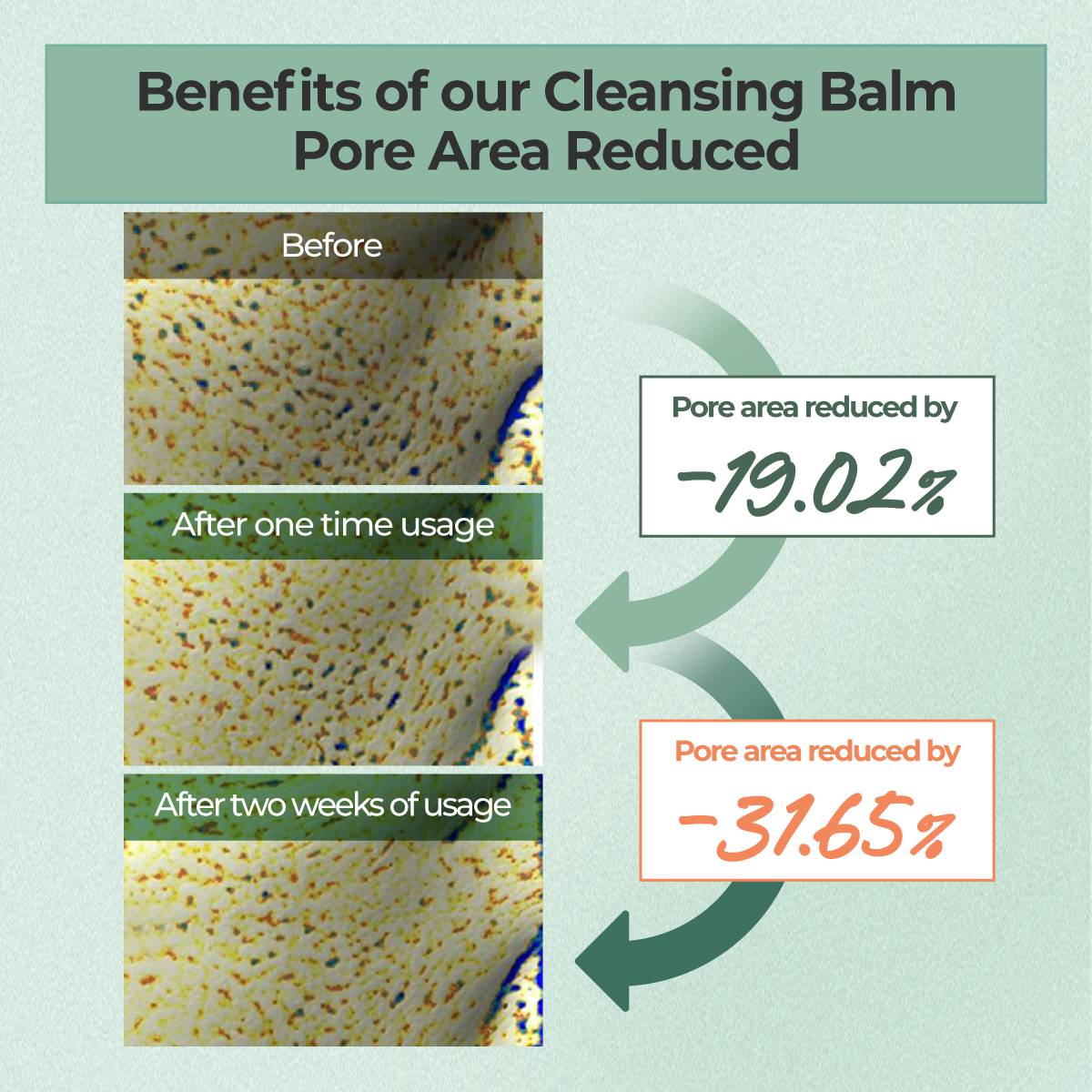 numbuzin No.3 Cleansing Balm 85g pore area reduced before and after test results